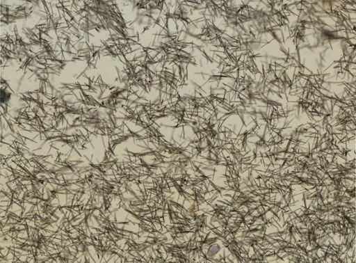 Isodictya deichmannae