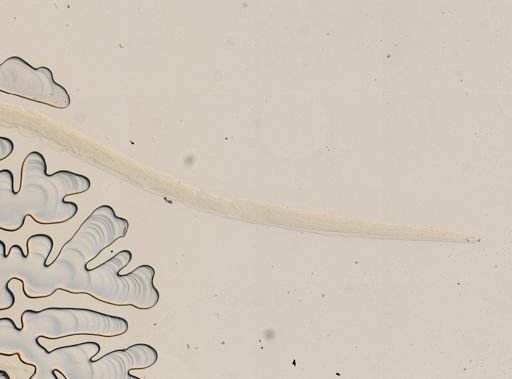 Haemonchus contortus