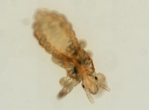 Pediculus humanus