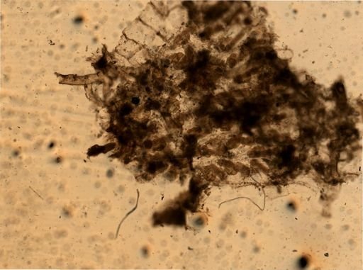 Bryozoa