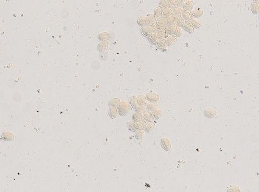 Ascaris lumbricoides