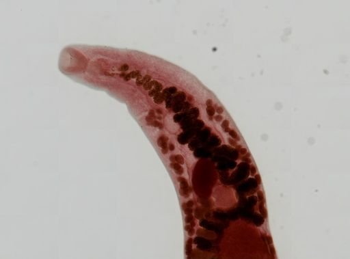 Haematoloechus medioplexus