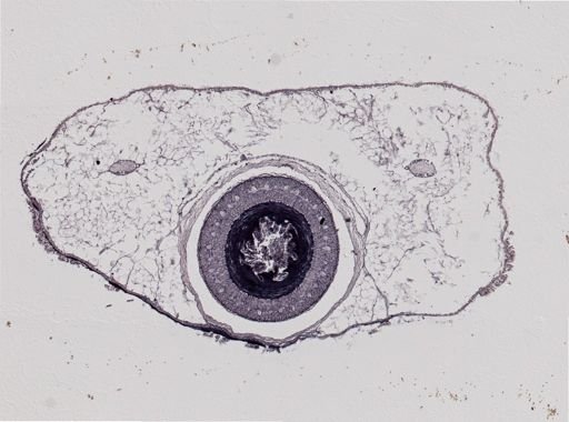 Plotonemertes adhaerens
