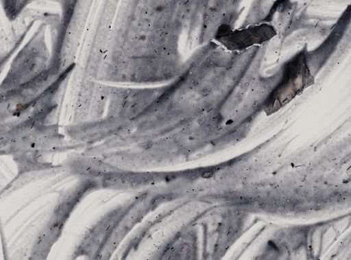 Entamoeba histolytica