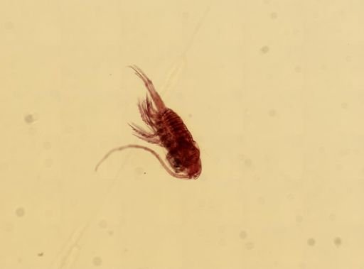 Centropages typicus