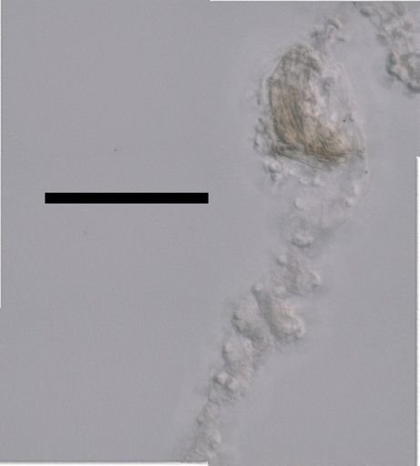 Apolemia lanosa