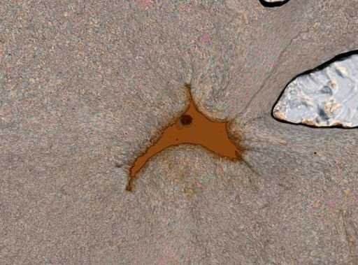 Ploesoma lenticulare