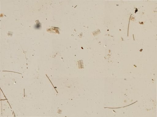 Bacillariophyceae
