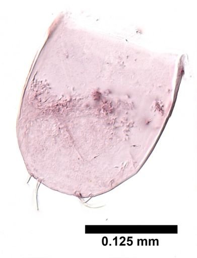 Hyalella cf. azteca