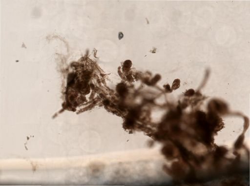 Bryozoa