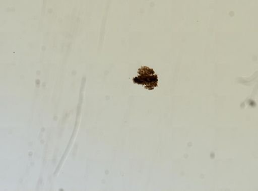 Chirocephalus