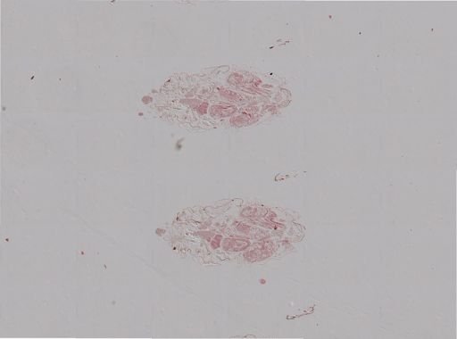Rhopalosiphum nymphaeae