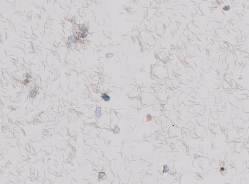 Haliclona (Haliclona)
