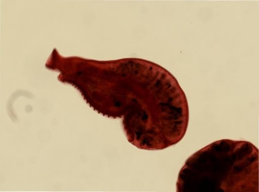 Aspidogaster conchicola
