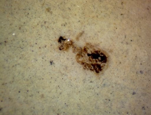 undet. Coleoptera