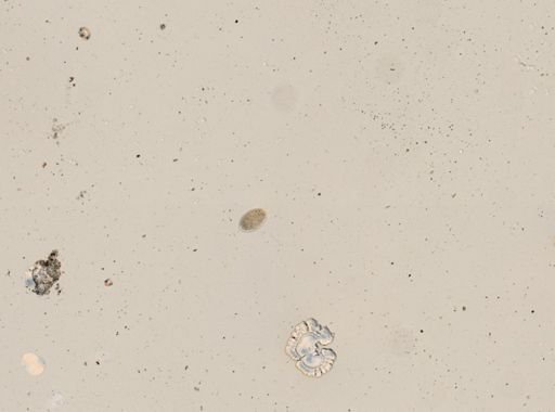 Trichuris vulpis