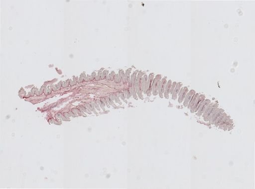 Plicatoperipatus jamaicensis
