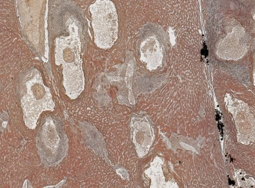 Taenia crassicollis