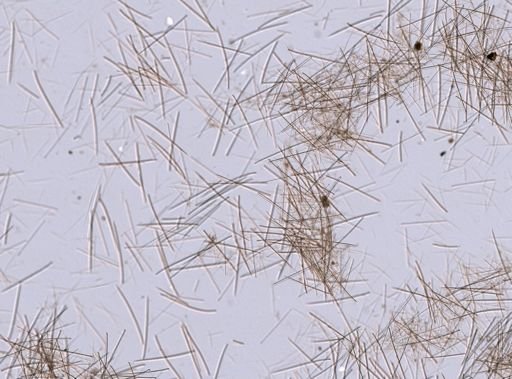 Tedania suctoria