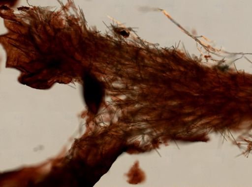 Microcionidae?