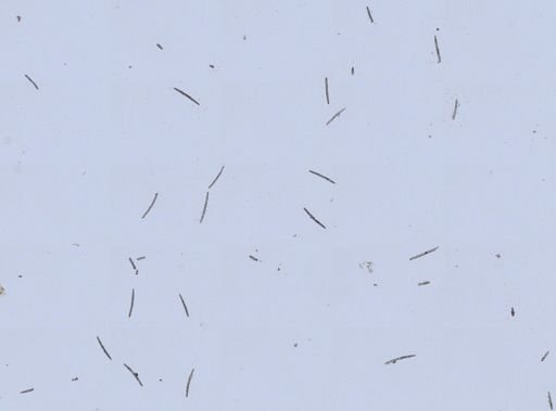 Trochospongilla pennsylvanica