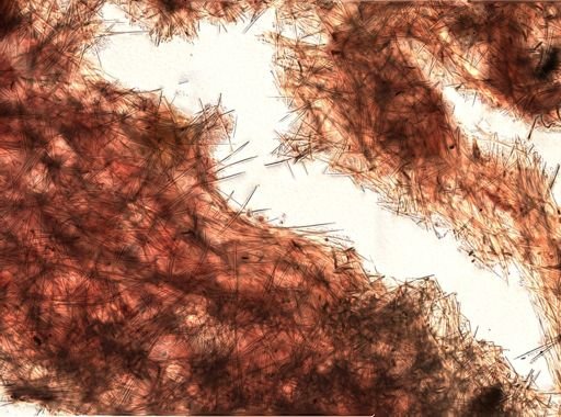 Halichondria sp.