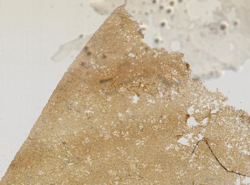 Treponema pallidum