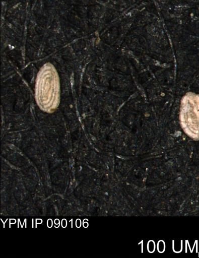 Spirolocammina planula