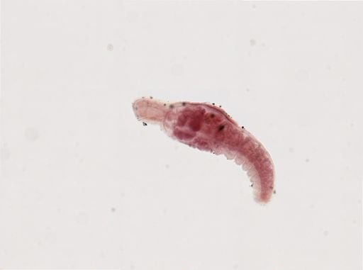 Chaetogaster limnaei