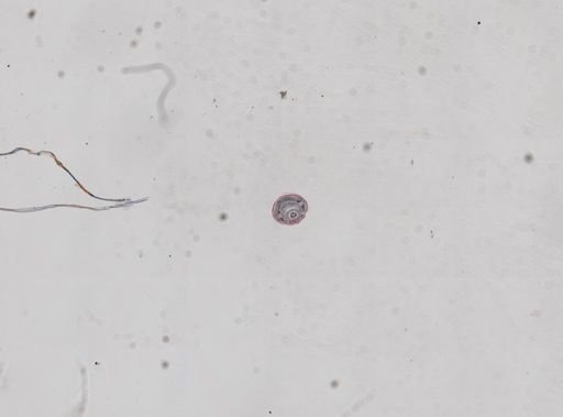 Lineus sanguineus