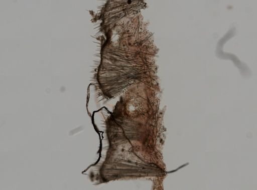 Spirastrella?
