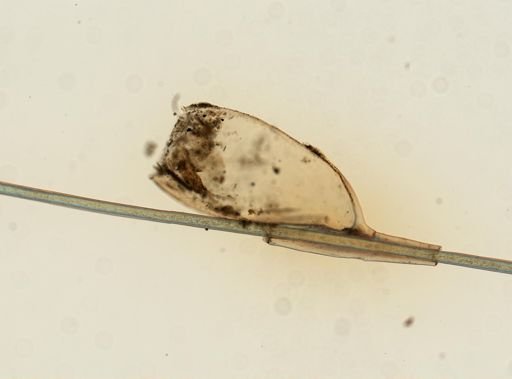 Pediculus humanus