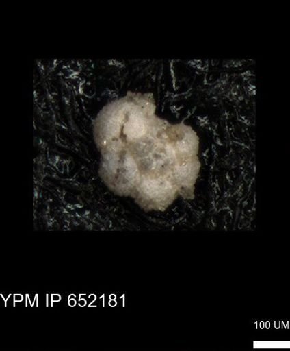 undet. Rugoglobigerinidae