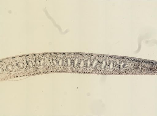 Turbellaria