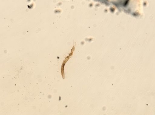 Eosentomon vermiforme