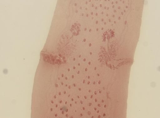 Dipylidium caninum