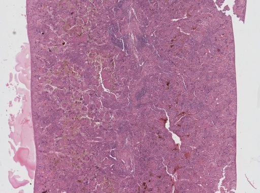 Leishmania donovani