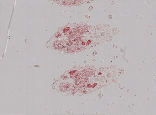 Rhopalosiphum nymphaeae