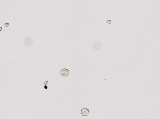 Cestoda
