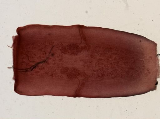 Dipylidium caninum