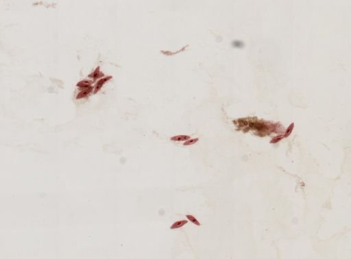 Paramecium
