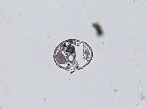 Anoplodactylus lentus