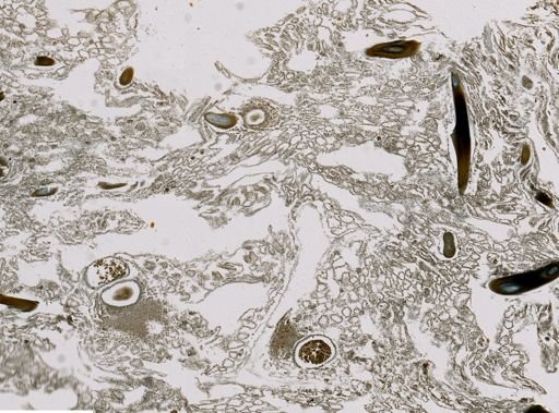Spongionella nigra