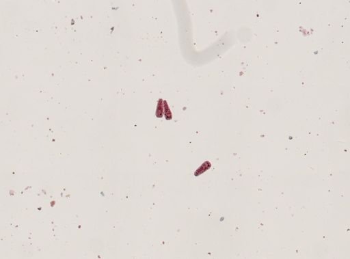 Fasciola hepatica