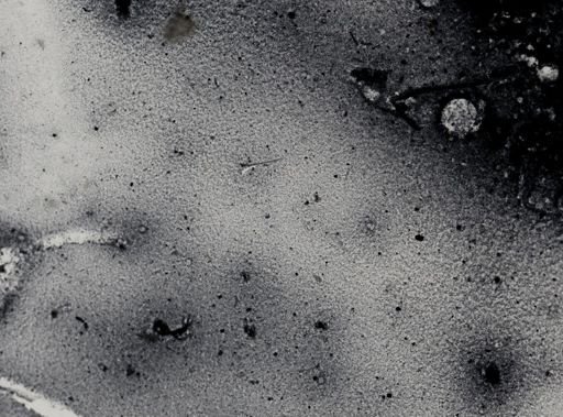 Entamoeba coli