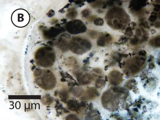 Megasphaera miniscula
