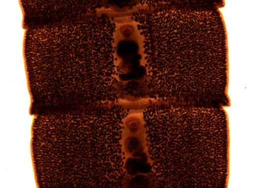 Diphyllobothrium erinacei