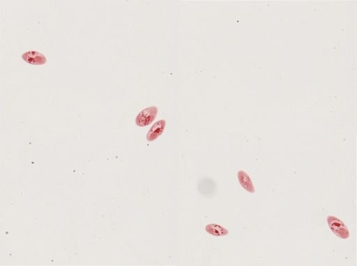 Paramecium calkinsi