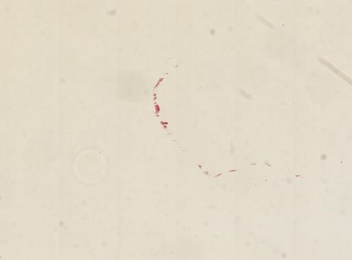 Amoeba proteus