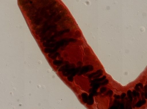 Platyhelminthes